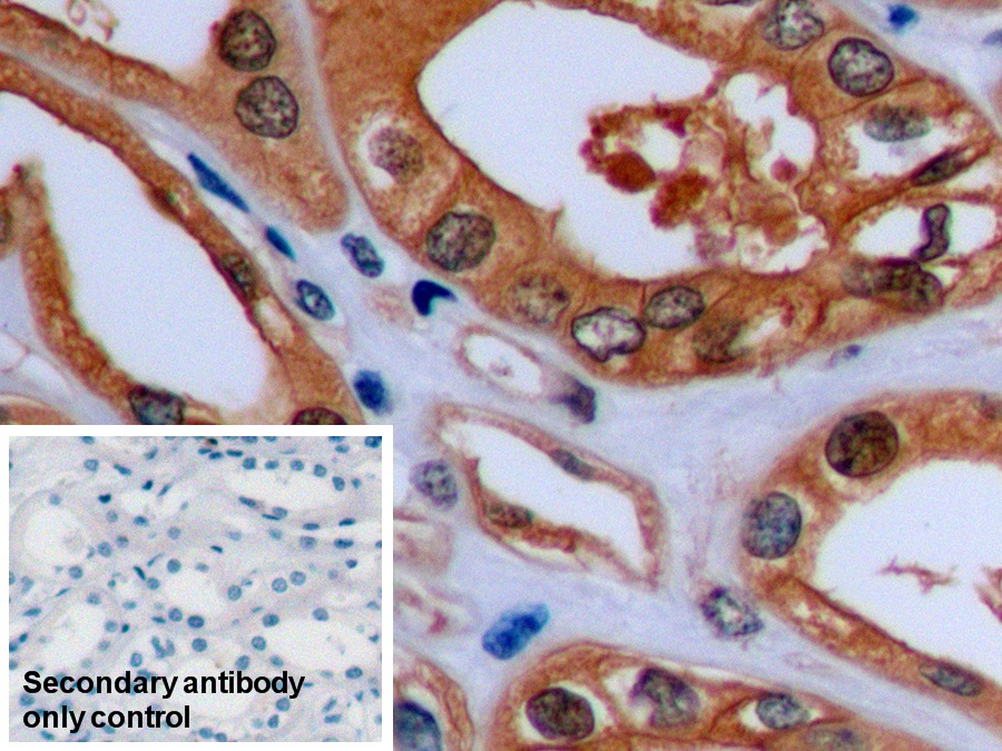 Monoclonal Antibody to Beta Actin (ACTB)