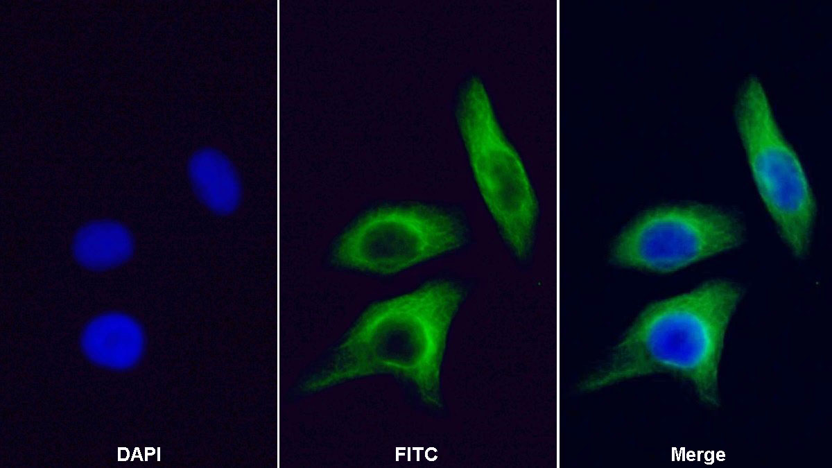 Monoclonal Antibody to Beta Actin (ACTB)