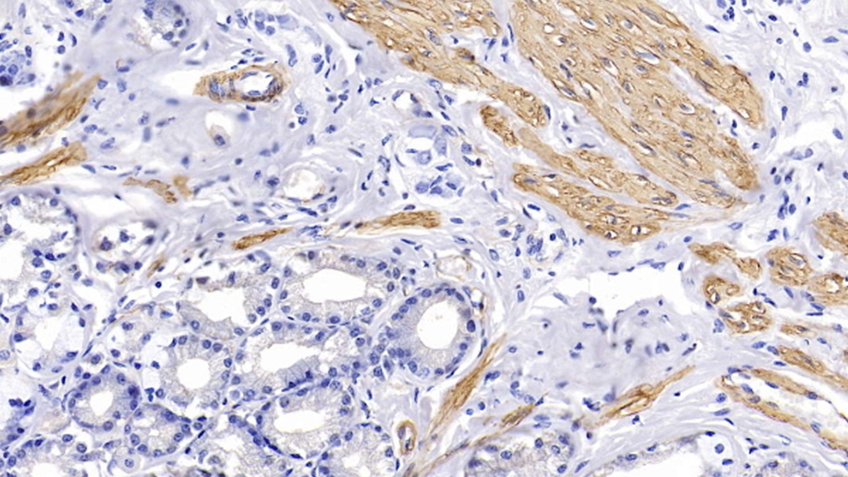 Monoclonal Antibody to Actin Alpha 1, Cardiac Muscle (ACTC1)