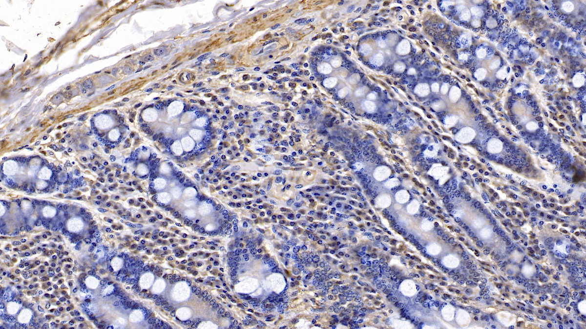 Monoclonal Antibody to Actin Alpha 1, Cardiac Muscle (ACTC1)