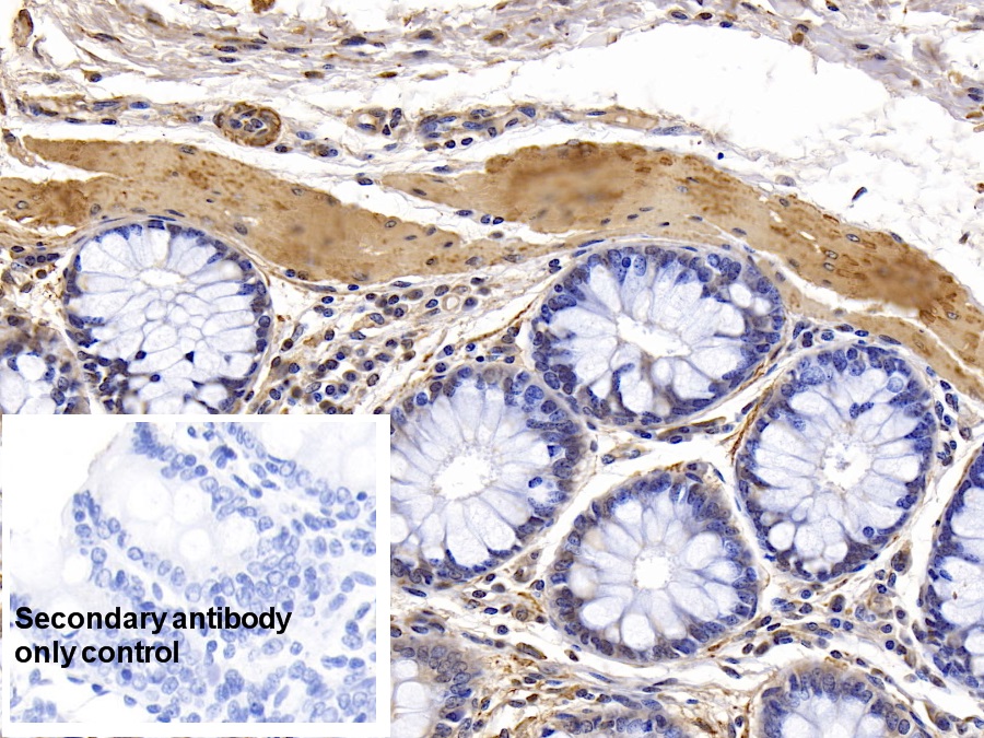 Monoclonal Antibody to Actin Alpha 1, Cardiac Muscle (ACTC1)