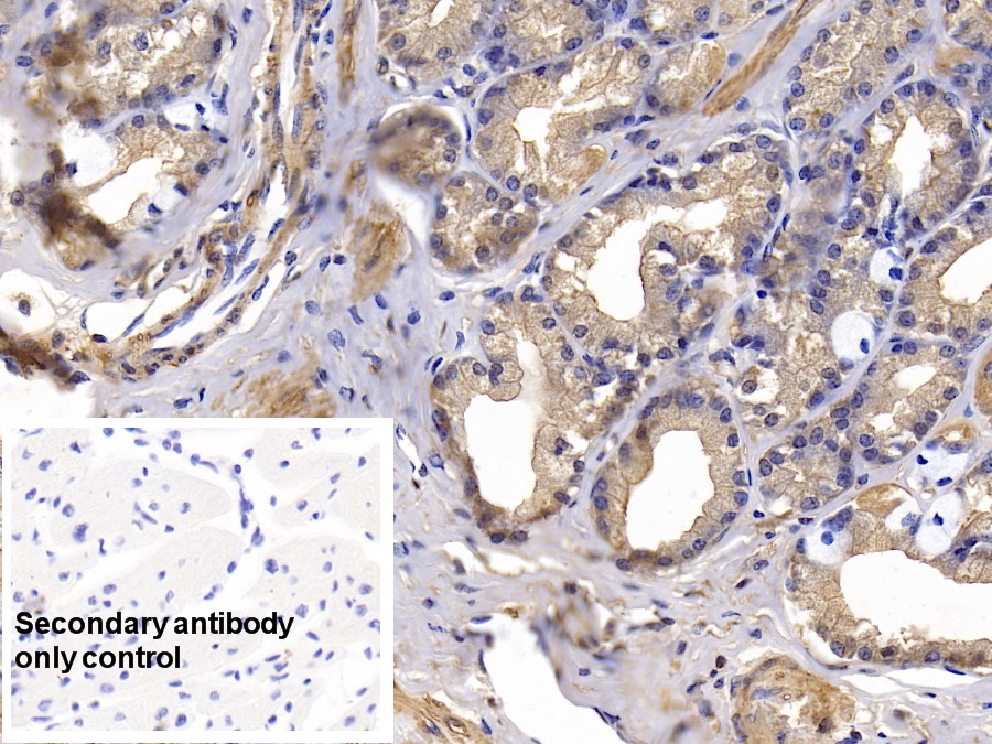 Monoclonal Antibody to Actin Alpha 1, Cardiac Muscle (ACTC1)