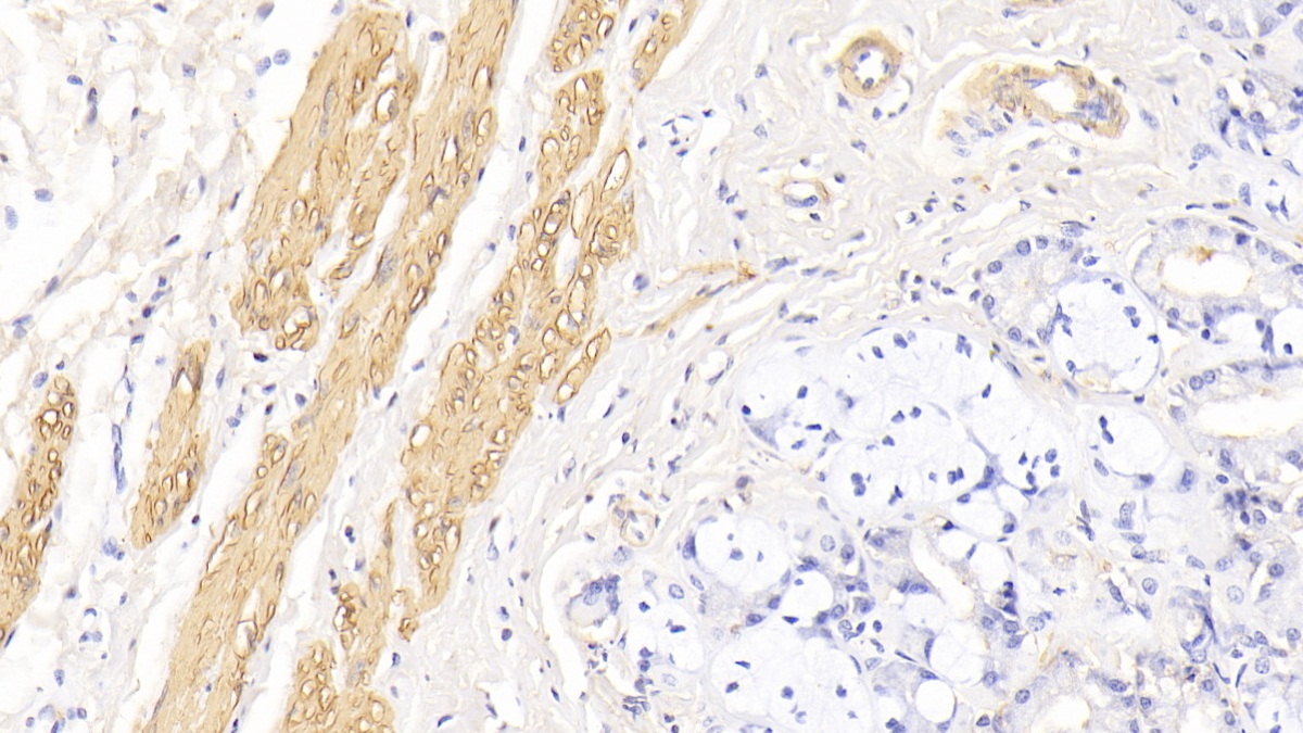 Monoclonal Antibody to Actin Alpha 1, Cardiac Muscle (ACTC1)