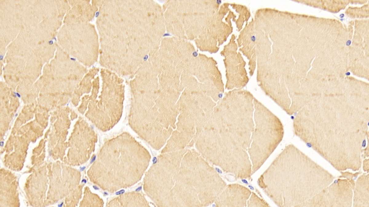 Monoclonal Antibody to Actin Alpha 1, Cardiac Muscle (ACTC1)