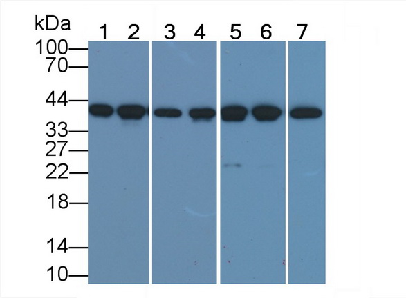 Monoclonal Antibody to Actin Alpha 1, Cardiac Muscle (ACTC1)