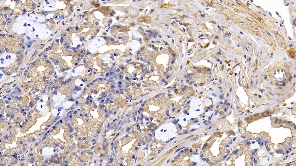 Monoclonal Antibody to Actin Alpha 1, Cardiac Muscle (ACTC1)