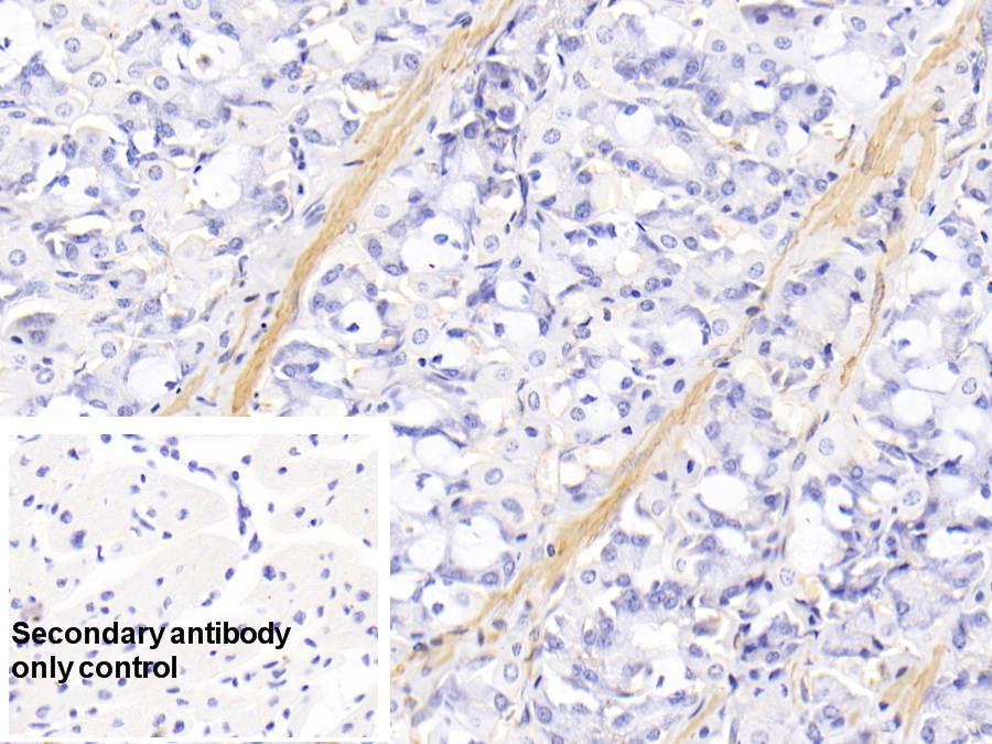 Monoclonal Antibody to Actin Alpha 1, Cardiac Muscle (ACTC1)