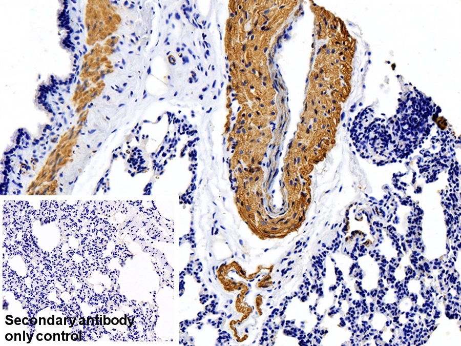 Monoclonal Antibody to Actin Alpha 1, Cardiac Muscle (ACTC1)