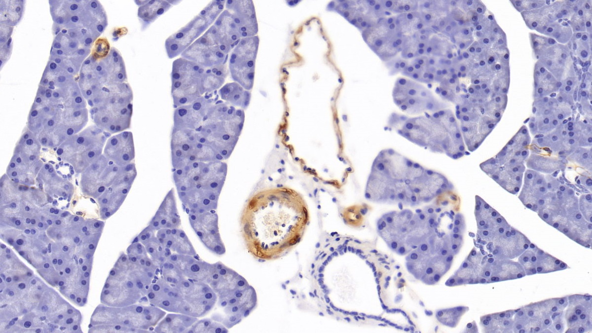 Monoclonal Antibody to Actin Alpha 2, Smooth Muscle (ACTa2)