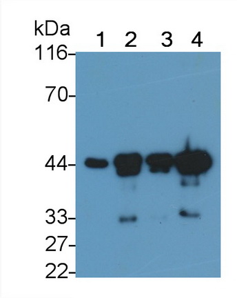 Monoclonal Antibody to Actin Alpha 2, Smooth Muscle (ACTa2)