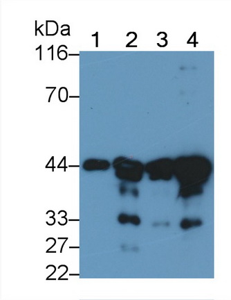 Monoclonal Antibody to Actin Alpha 2, Smooth Muscle (ACTa2)