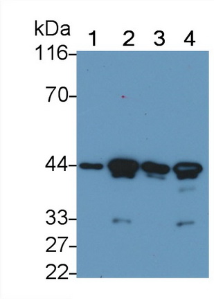 Monoclonal Antibody to Actin Alpha 2, Smooth Muscle (ACTa2)