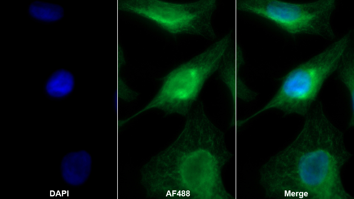 Monoclonal Antibody to Bcl2 Associated X Protein (Bax)