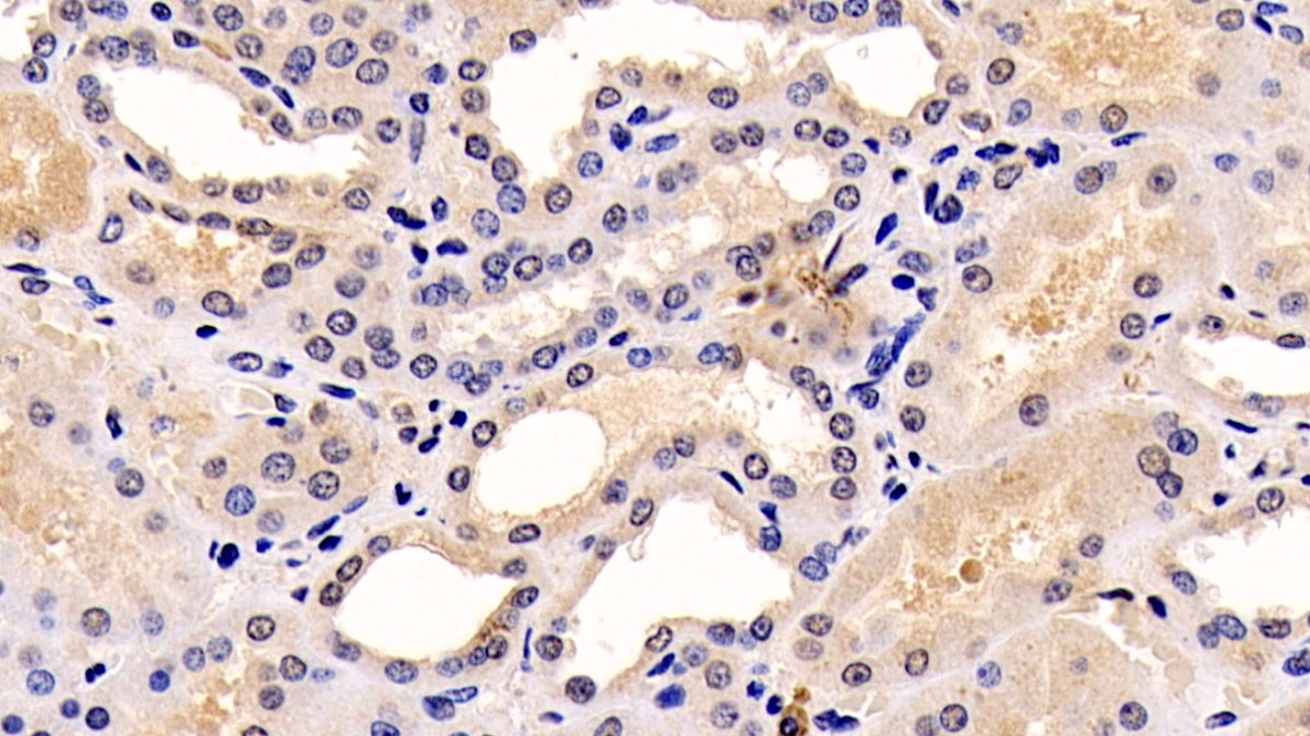 Monoclonal Antibody to Extracellular Signal Regulated Kinase 1 (ERK1)