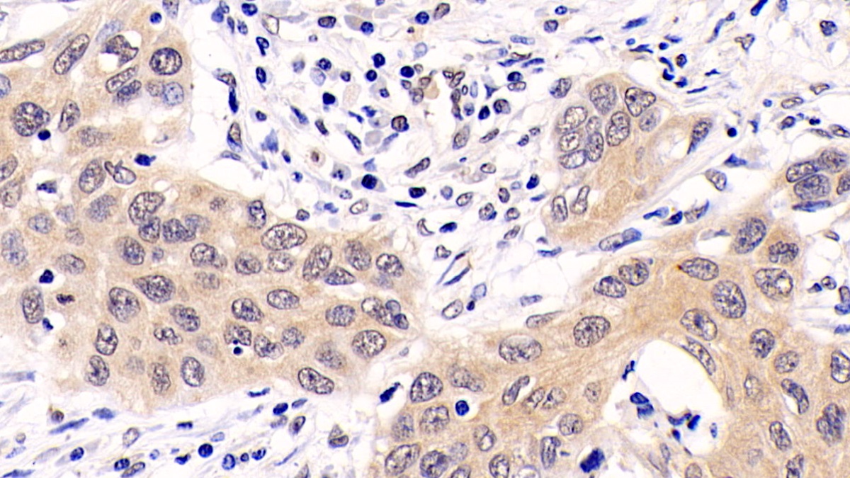 Monoclonal Antibody to Extracellular Signal Regulated Kinase 1 (ERK1)