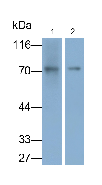Monoclonal Antibody to Glucokinase Regulatory Protein (GKRP)