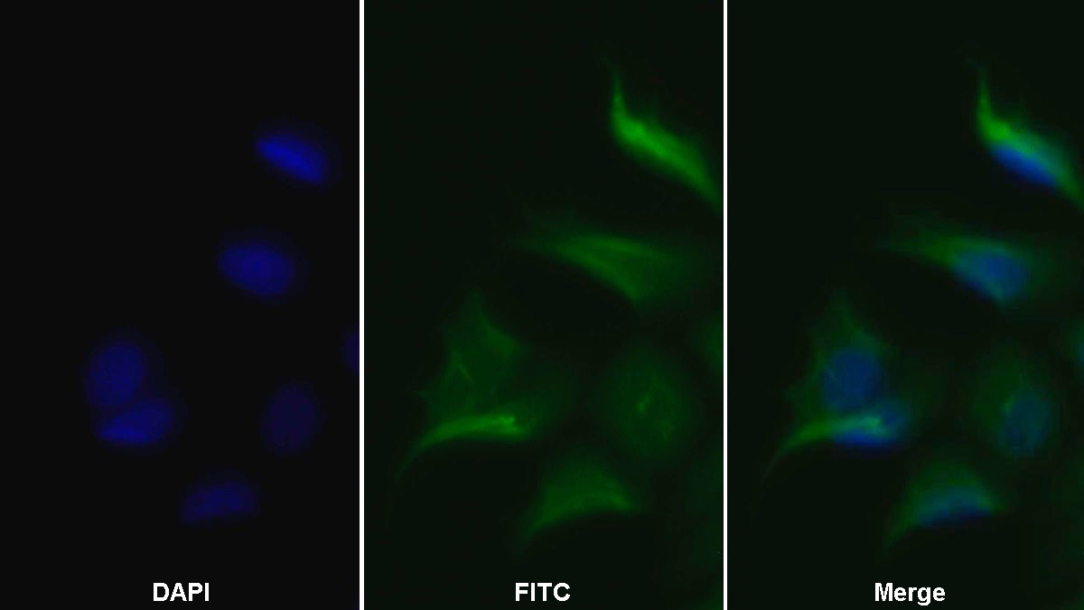 Monoclonal Antibody to Vascular Endothelial Growth Factor Receptor 2 (VEGFR2)