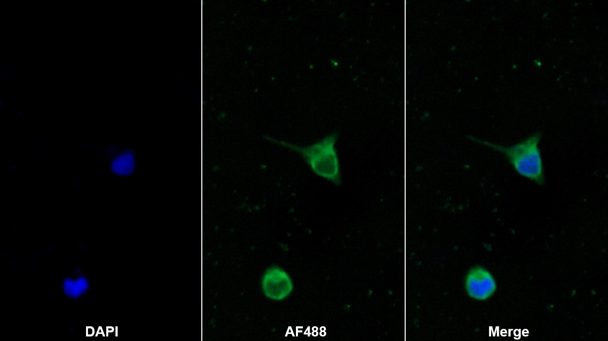 Monoclonal Antibody to Serpin B3 (SERPINB3)
