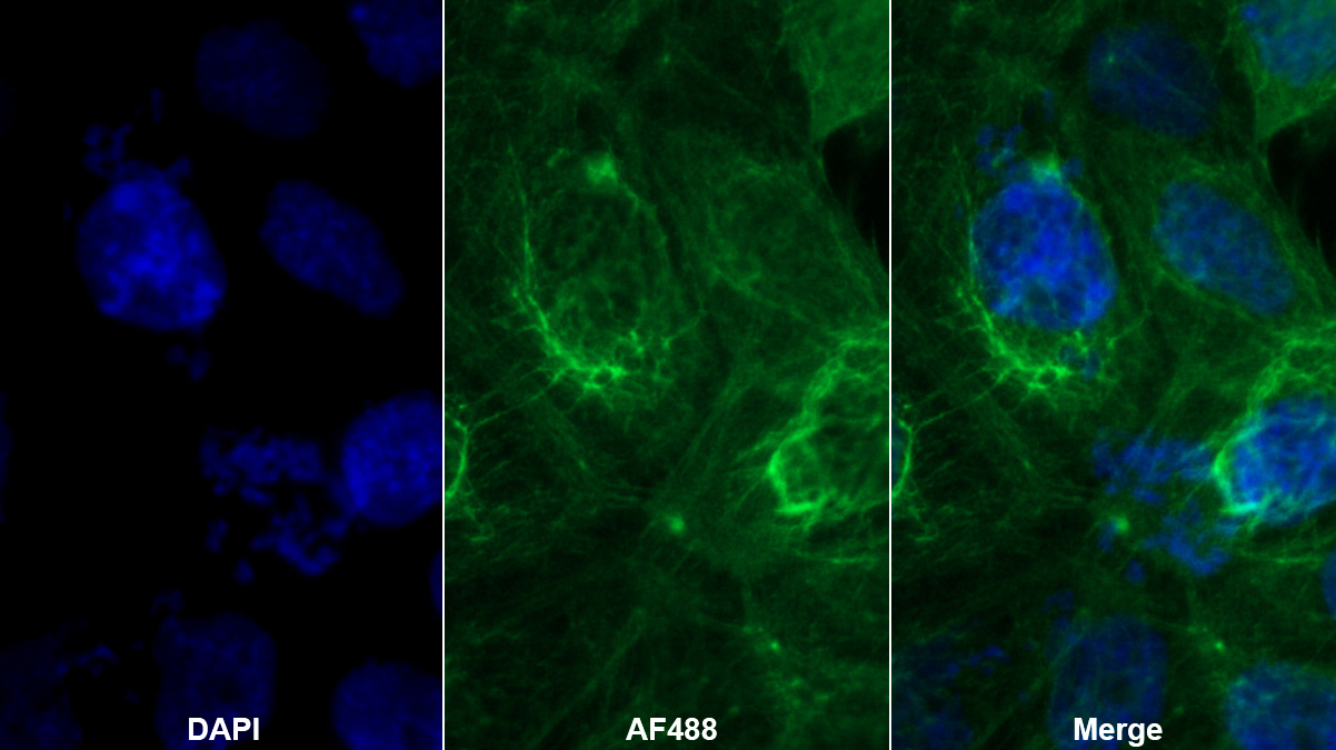 Monoclonal Antibody to Neutrophil gelatinase-associated lipocalin (NGAL)