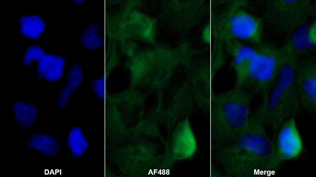 Monoclonal Antibody to Neutrophil gelatinase-associated lipocalin (NGAL)