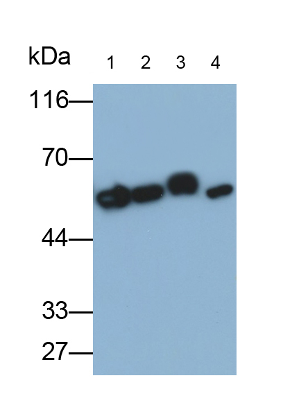 Monoclonal Antibody to Interferon Alpha/Beta Receptor 1 (IFNa/bR1)
