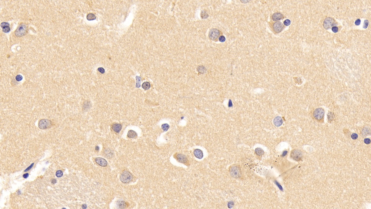 Monoclonal Antibody to Interferon Alpha/Beta Receptor 1 (IFNa/bR1)