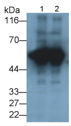 Monoclonal Antibody to Tyrosine Hydroxylase (TH)