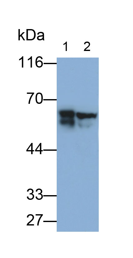 Monoclonal Antibody to Tyrosine Hydroxylase (TH)