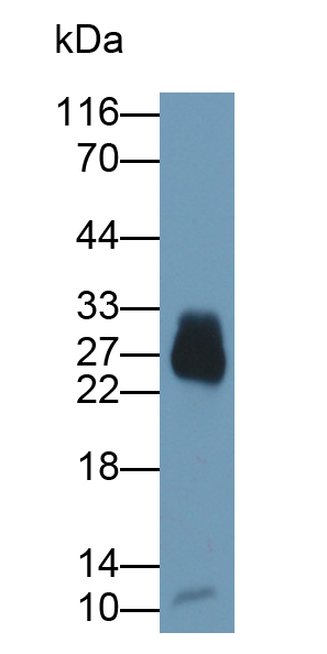 Monoclonal Antibody to Azurocidin (AZU)