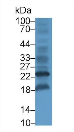 Monoclonal Antibody to Heparin Binding Epidermal Growth Factor Like Growth Factor (HBEGF)