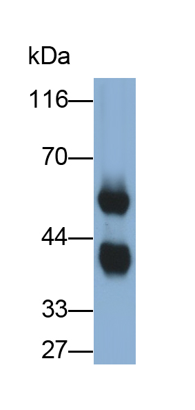 Monoclonal Antibody to Salivary Alpha Amylase (AMY1A)