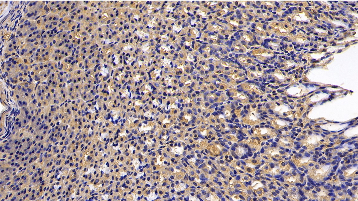 Monoclonal Antibody to Calreticulin (CALR)