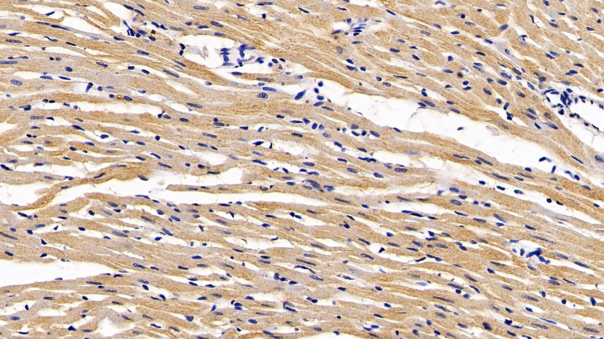 Monoclonal Antibody to Calreticulin (CALR)