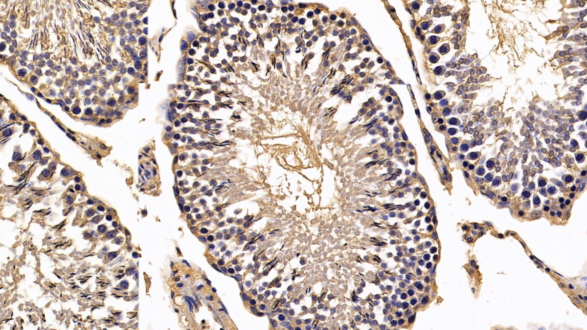 Monoclonal Antibody to Calreticulin (CALR)