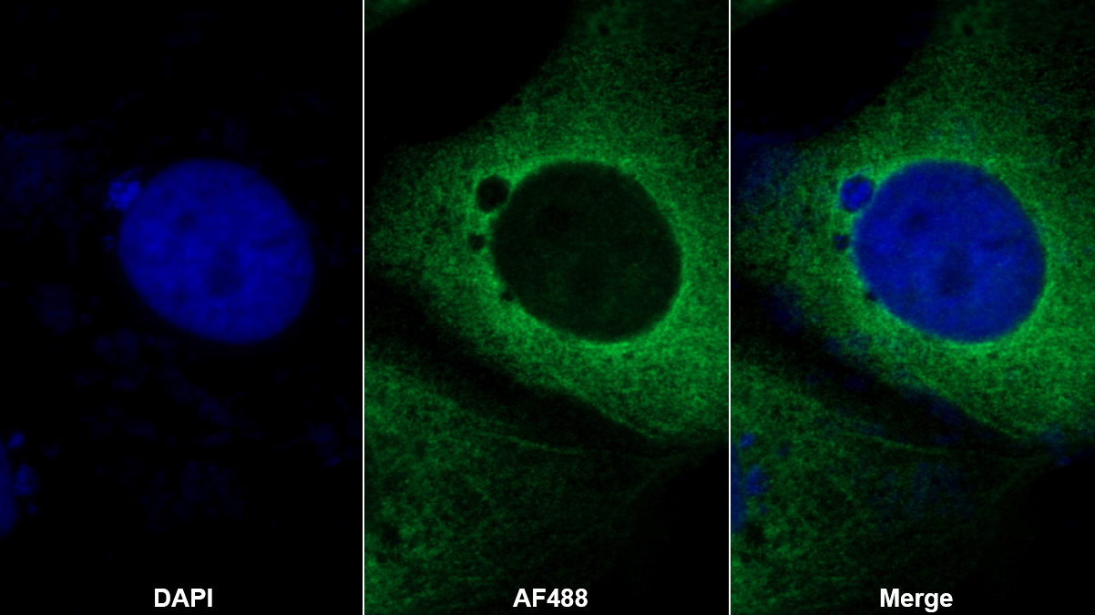 Monoclonal Antibody to Prominin 1 (PROM1)