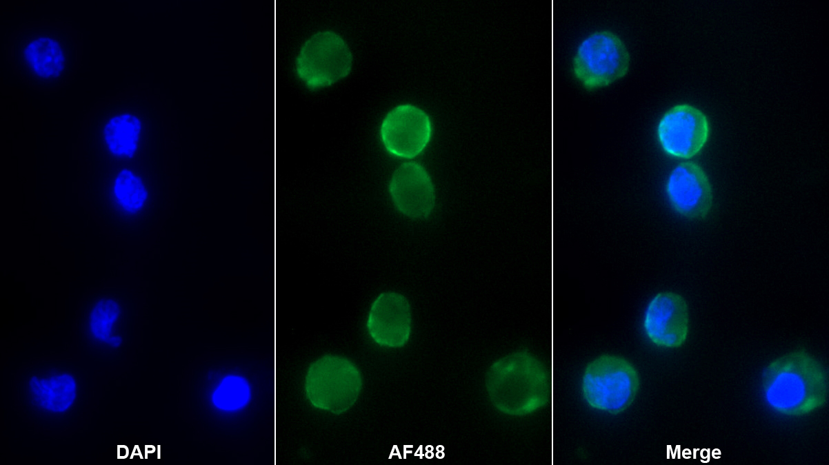 Monoclonal Antibody to Interleukin 1 Receptor Associated Kinase 3 (IRAK3)