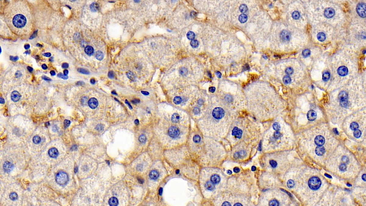 Monoclonal Antibody to Cluster Of Differentiation 147 (CD147)