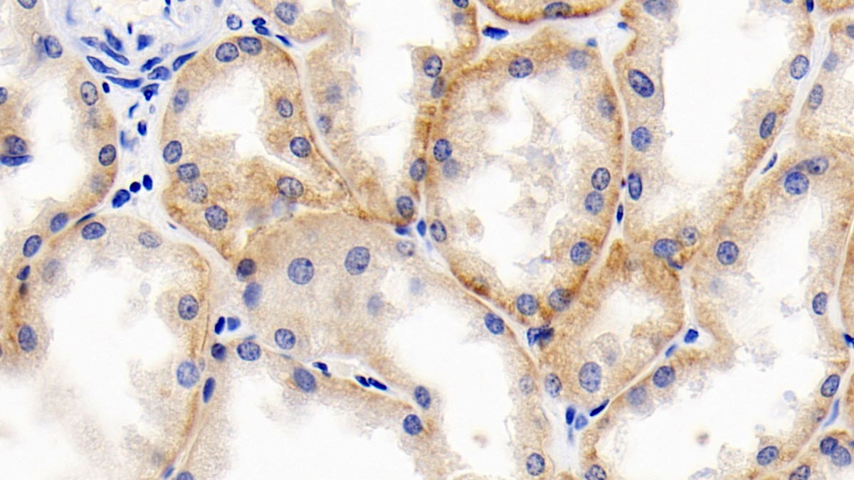 Monoclonal Antibody to Cluster Of Differentiation 147 (CD147)