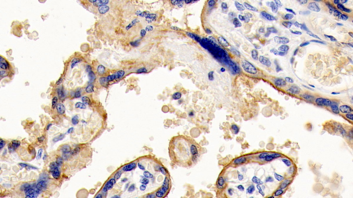 Monoclonal Antibody to Cluster Of Differentiation 147 (CD147)