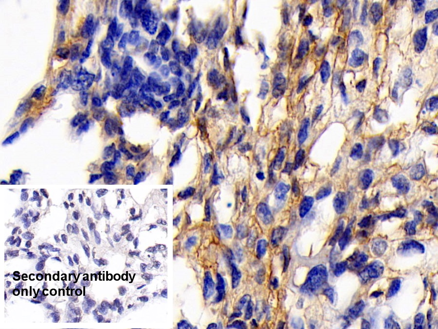 Monoclonal Antibody to Cluster Of Differentiation 147 (CD147)