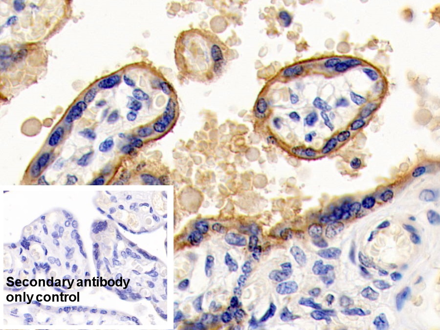 Monoclonal Antibody to Cluster Of Differentiation 147 (CD147)