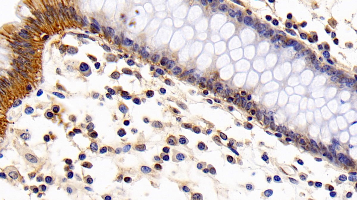 Monoclonal Antibody to Cluster Of Differentiation 147 (CD147)