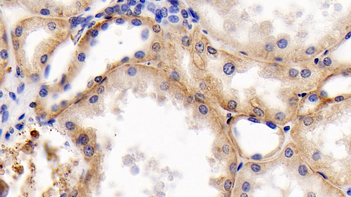 Monoclonal Antibody to Cluster Of Differentiation 147 (CD147)