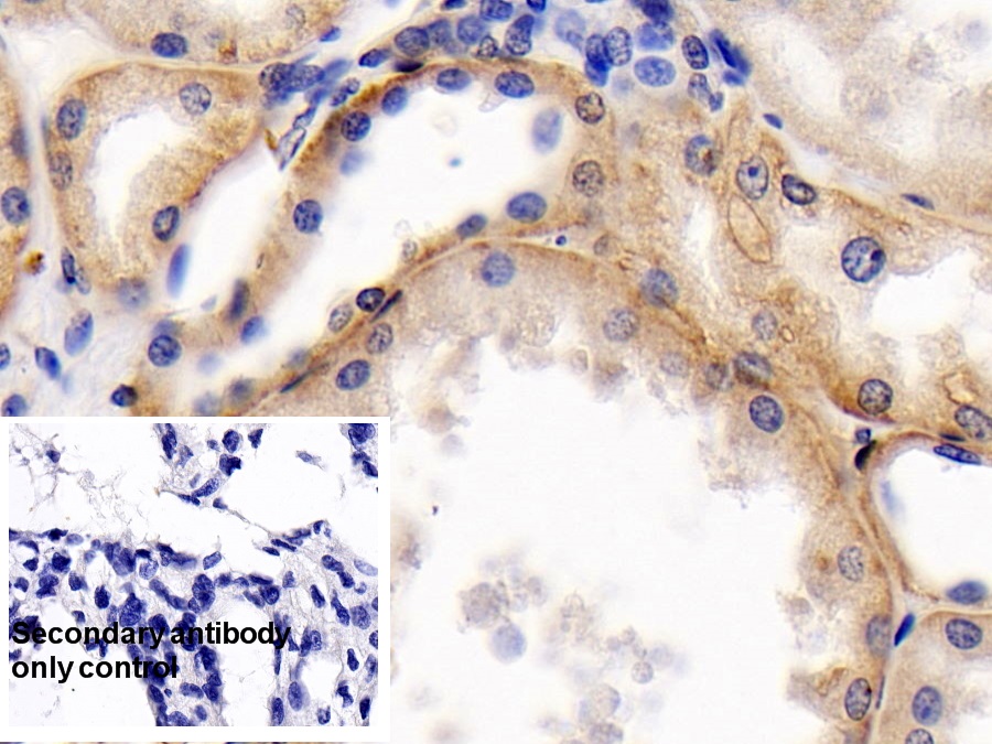 Monoclonal Antibody to Cluster Of Differentiation 147 (CD147)