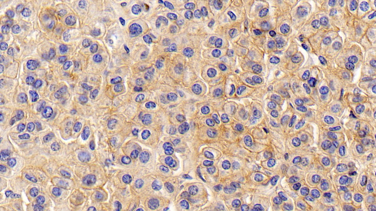 Monoclonal Antibody to Cluster Of Differentiation 147 (CD147)