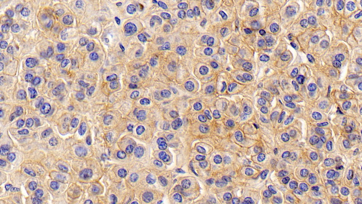 Monoclonal Antibody to Cluster Of Differentiation 147 (CD147)