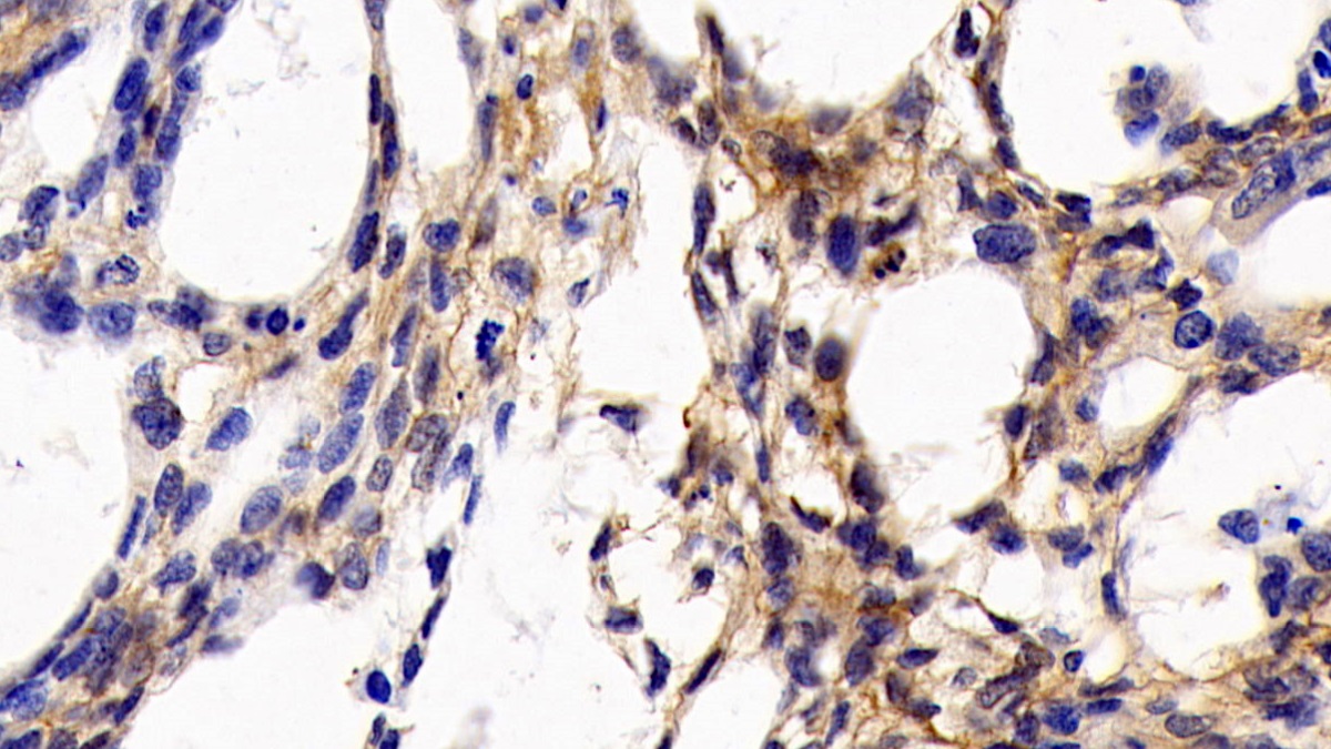 Monoclonal Antibody to Cluster Of Differentiation 147 (CD147)