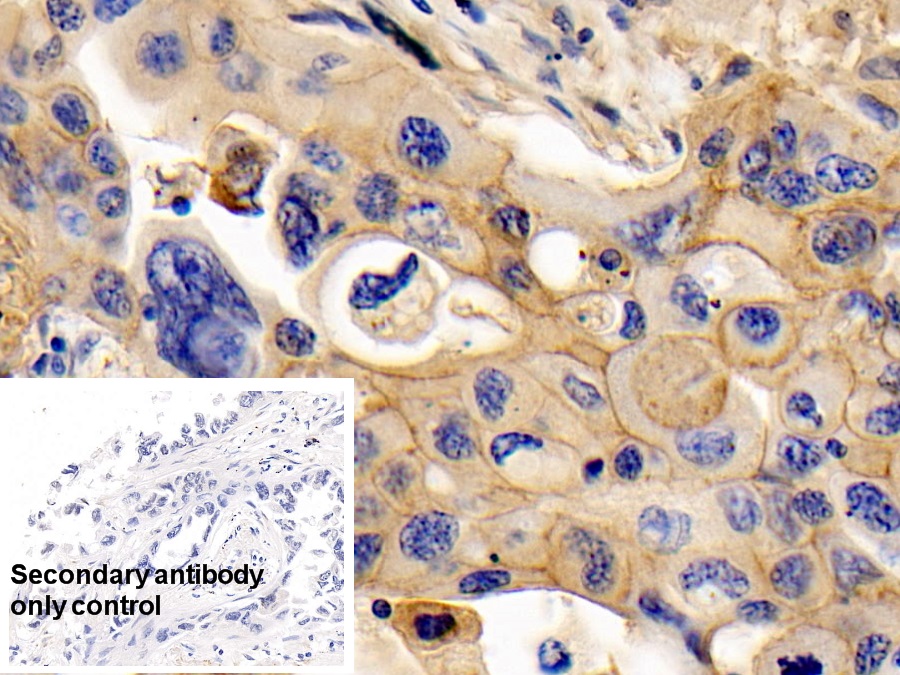 Monoclonal Antibody to Cluster Of Differentiation 147 (CD147)