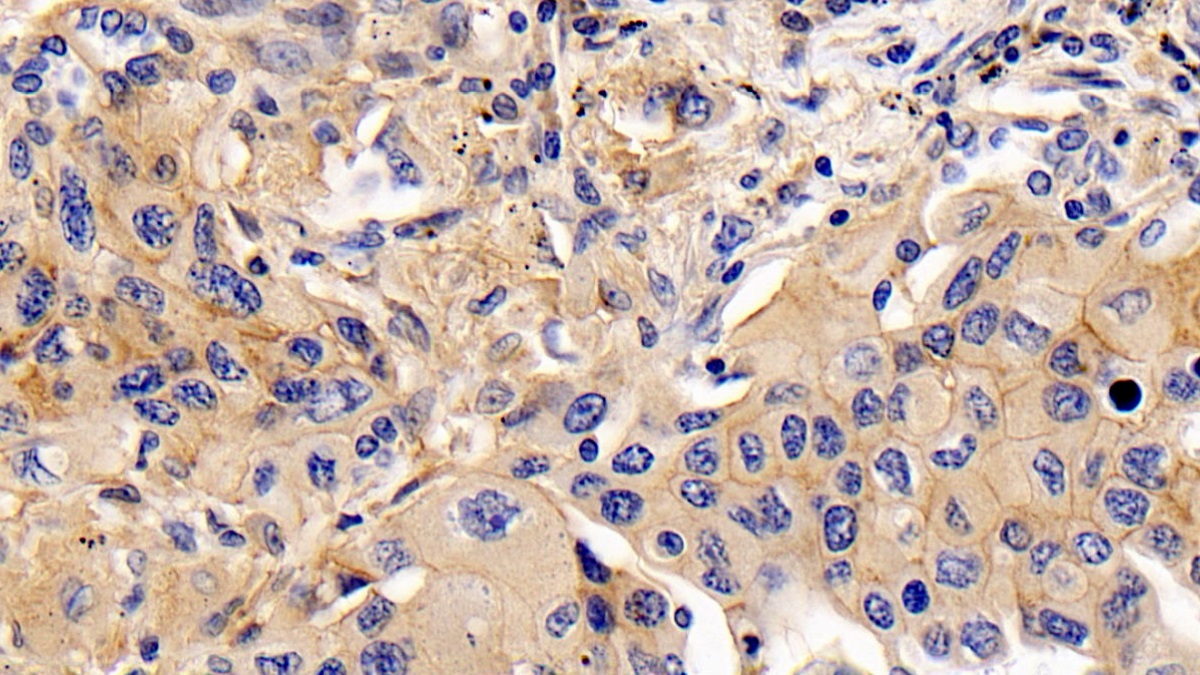 Monoclonal Antibody to Cluster Of Differentiation 147 (CD147)