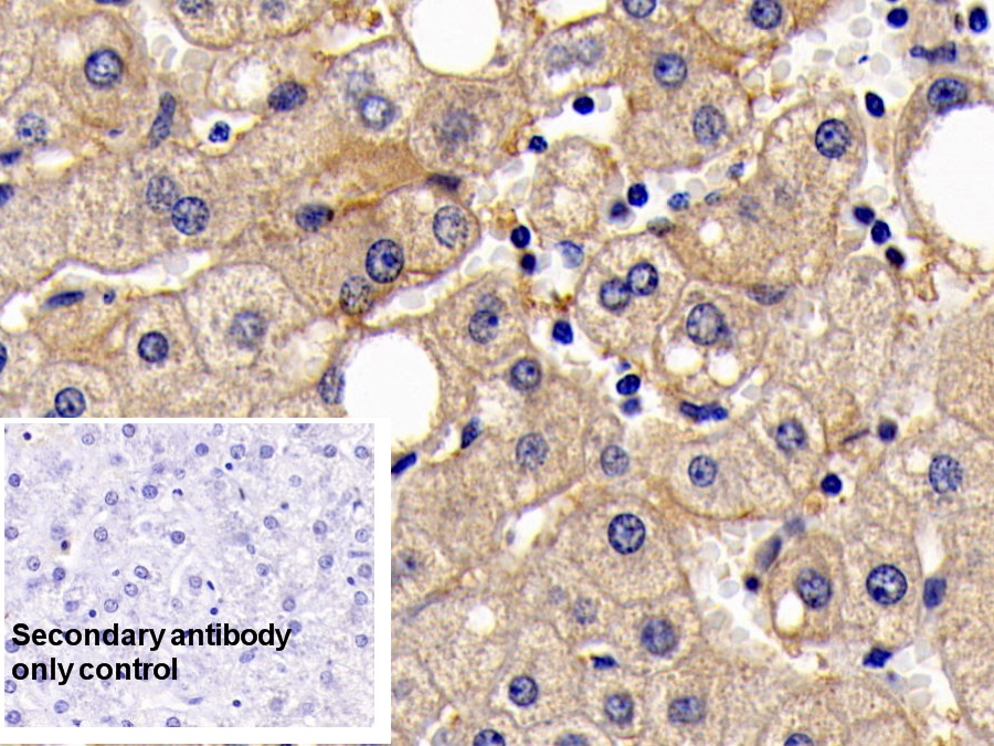 Monoclonal Antibody to Cluster Of Differentiation 147 (CD147)